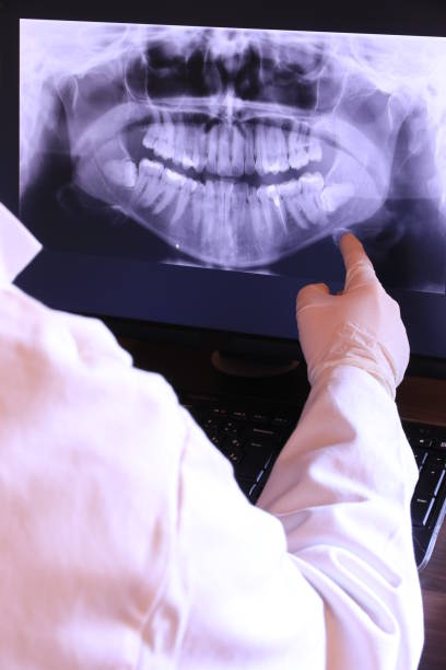 Best Broken or Chipped Tooth Repair in Gregory, TX