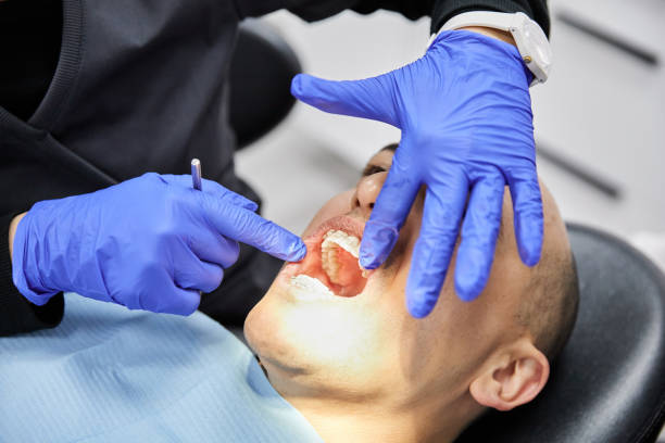 Best Emergency Cosmetic Dentistry (e.g., broken veneers) in Gregory, TX